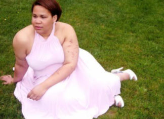 Why I Showed My Self-Injury Scars On My Dating Profile woman-self-harm-scars