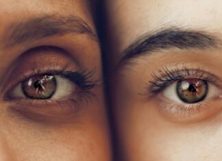 No More Raccoon Eyes: How I Finally Dealt With My Beauty Concerns