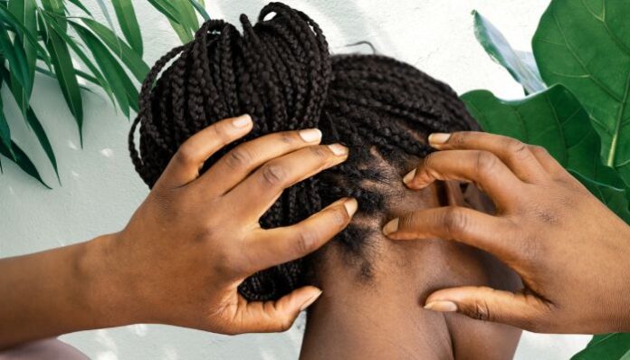 Scalp Pain Woman Scratching Scalp
