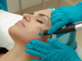 Can RF Microneedling Help Reduce Acne Scars?