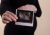 Pregnancy 101: The Essential Guide To Preparing For A Baby