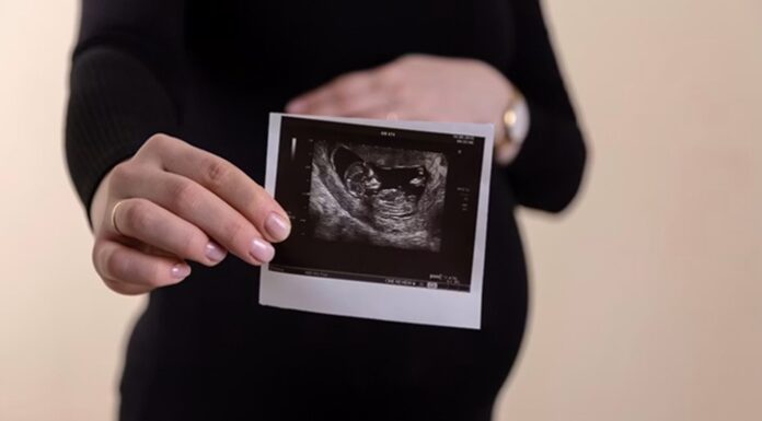 Pregnancy 101: The Essential Guide To Preparing For A Baby